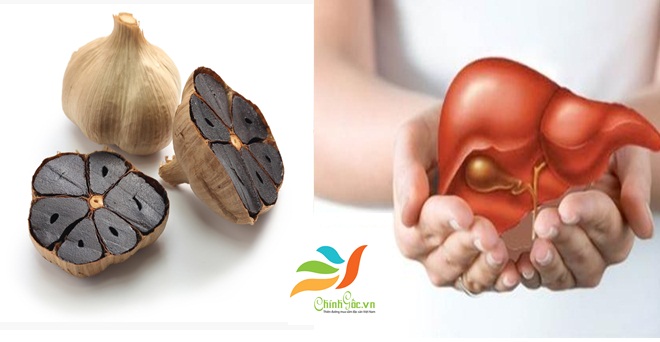 Giải độc gan bằng tỏi đen
