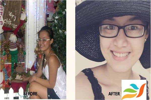 Chị Nguyễn Thùy Dương đã thành công với hốn hợp làm trắng da từ nấm Linh Chi